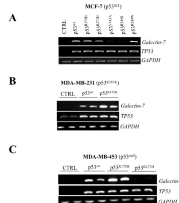 Figure  3.    Mutant  p53  induces  galectin-7  expression  in breast cancer cell lines