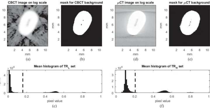 Fig. 1. Background artifacts. (a) Background artifacts on the CBCT image on log scale