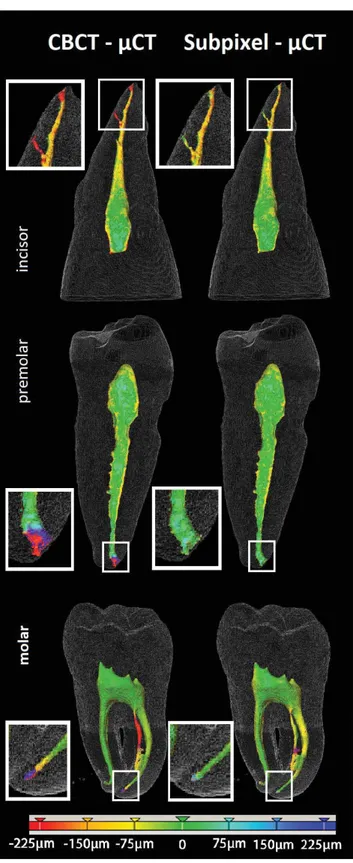 Fig. 7. Volumetric segmentation of the root canal on the test set (an upper incisor, a lower premolar tooth, and a lower molar)