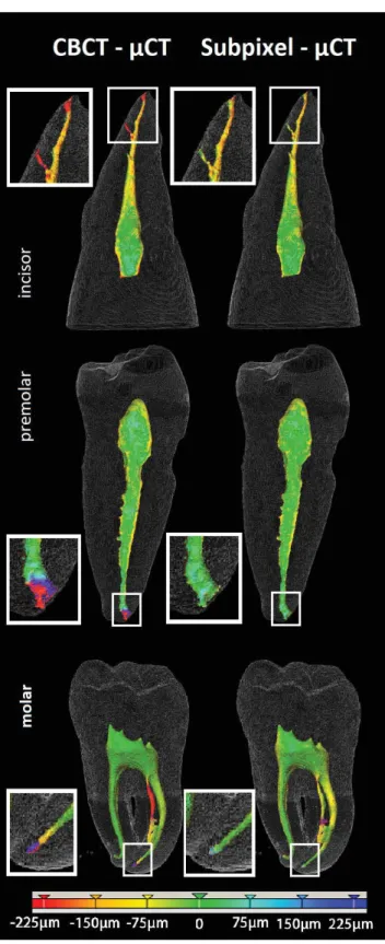 Fig. 7. Volumetric segmentation of the root canal on the test set (an upper incisor, a lower premolar tooth, and a lower molar)