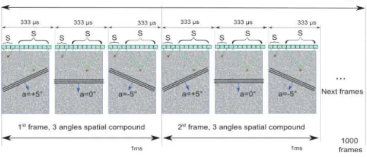 Fig. 5. Sensitive Doppler sequence consisting in 3 tilted US plane waves [-5°, 0°, +5°] obtained at a frame rate of 3 kHz during 1 s