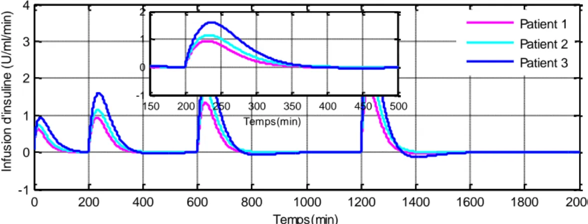 Fig. II.14: L’infusion d’insuline du modèle de Bergman (MBG), simulation  avec une valeur  initiale  G ( t )  x 1 ( 0 )  250 ( mg / dl )  sous contrôleur DMRAC avec perturbation