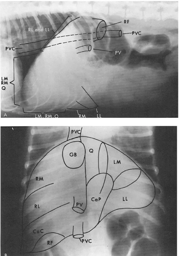 Figure 11: Anatomie radiographique normale du foie (O’Brien, 1978). A : vue latérale  droite