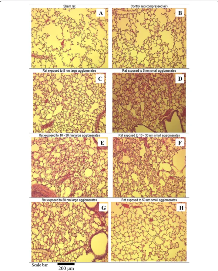 Figure 8 Optical microscopy images (100-x) of lung tissue sections. Morphological assessments of lung tissue stained with haematoxylin and eosin of sham (A), control (exposed to compressed air) and TiO 2 NP exposed rats by means of inhalation for 6 hours