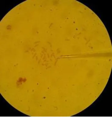 Figure  9  :  Image  au  microscope  inversé  d'une  métaphase  au  niveau  de  laquelle  l'aiguille de microdissection (à droite) a été approchée (grossissement x 1000) 