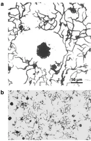 Fig. 7.  Micrographs  showing:  (a)  the  eﬀect  of  26  ppm  of  bismuth  [42 ,  49] ,  slow  cooling rate; (b) the eﬀect of lead on spheroidal graphite  iron  with 70  ppm of  lead  [7 ,  42] , intermediate cooling rate (the scale was not  reported but  