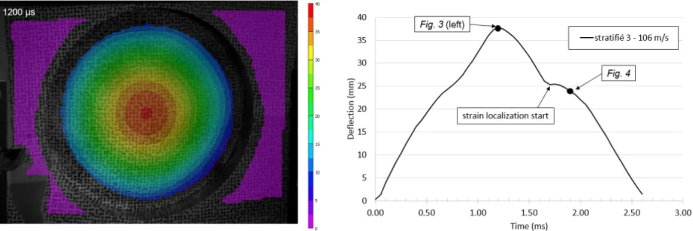 Fig. 4. Corrélation d’image du stratifié 3 impacté à 106 m/s : déplacement hors-plan (gauche), courbe déflection-temps (droite)