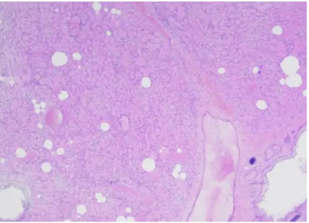 Figure 7 : Artefacts dus à la congélation sur une  Vet Diagnostics, 