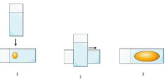 Figure 13 :  e (Rannou, 