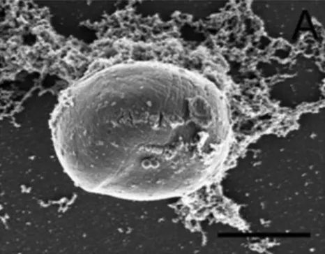 Figure 2 : Image d’un oocyste intact en microscopie électronique à balayage (Borowski et al., 2010)  Echelle 4 μm 
