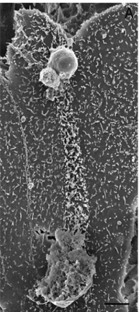 Figure 4 : Image des conséquences du cheminement d’un parasite à la surface d’un cellule sur les  microvillosités en microcopie électronique à balayage (Borowski et al., 2010)  