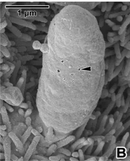 Figure 6 : Image d’un trophozoïte en cours de formation, enveloppé par la membrane parasitophore en  microscopie électronique à balayage (Valigurová et al., 2008) 