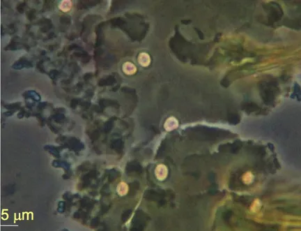 Figure 11 : Oocystes de Cryptosporidium colorés par la technique de Heine, observés en contraste de  phase (objectif 40) (Gargala, 2013) 