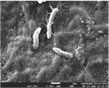 Fig. 2. Scanning electron micrograph of bacteria embedded within the cellulose microﬁbrils from kombucha tea.