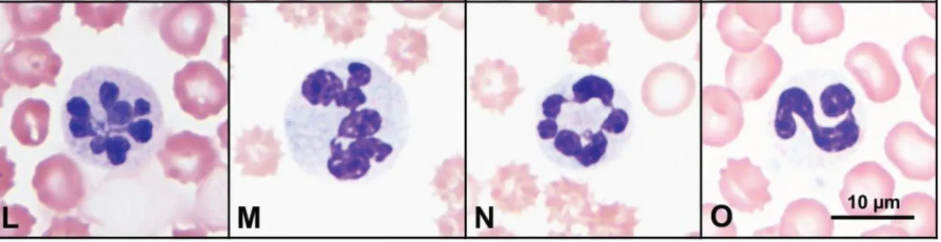 Figure 8 : Hypersegmentation des granulocytes neutrophiles lors d’hypocobalaminémie.  (L) GNN avec  corps de Döhle, (M – O) GNN hypersegmentés avec pour certains (M) une taille légèrement augmentée