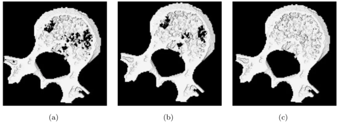 Figure 5.4: Application of the 3D tunnels closing algorithm to an 3D object with