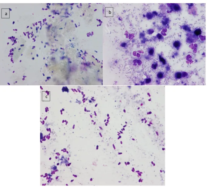 Figure 6 : Photos de différentes cytologies auriculaires pathologiques. a- Très grand nombre de levures à type de 
