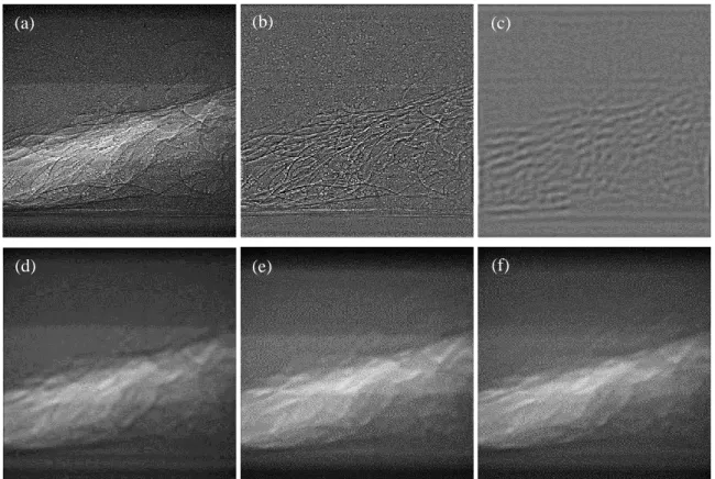 Figure 3.20. Image processing for vapour volume fraction measurements, (a) unprocessed X- X-ray image of cavitation; (b) detail component of wavelet decomposition; (c) detail component  processed by averaging filter; (d) first processed image in a pair; (e