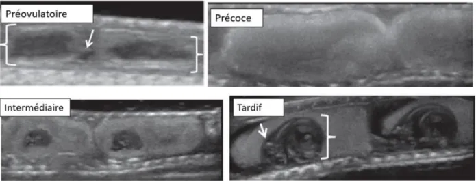Figure 15.  Echographie des follicules d’une femelle Tamnophis à quatre stades de développement  différents : follicule préovulatoire (signalé par la flèche), vitellogenèse précoce, développement 