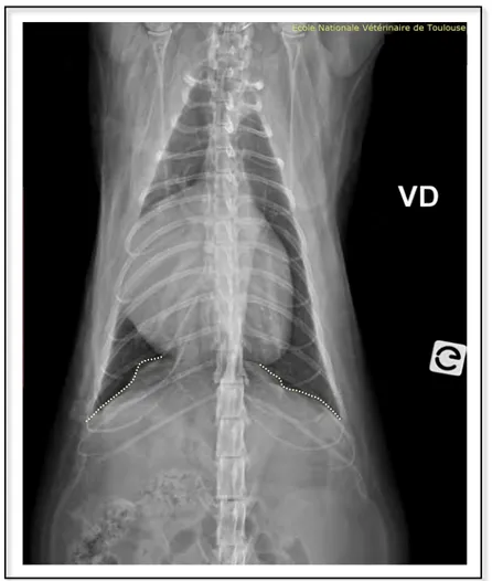 Figure	33	:	Radiographie	thoracique	de	face	d'un	chat	européen	mâle	castré	de	5	ans	atteint	 d’une	hernie	péritonéo-péricardique	 (Service	d’imagerie	de	l’ENVT) 	