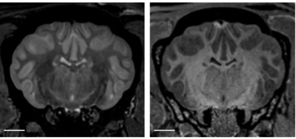 Figure 10. Coupes transversales d'encéphale ovin en pondération T2 à gauche et T1 à droite (Images obtenues à  l'institut des sciences du cerveau de Toulouse)