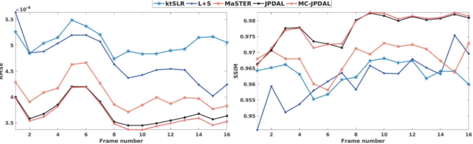 Fig. 8. Quantitative comparison of the two-chamber MRI sequences using the algorithms: ktSLR, L+S, MaSTER, the proposed JPDAL and MC-JPDAL