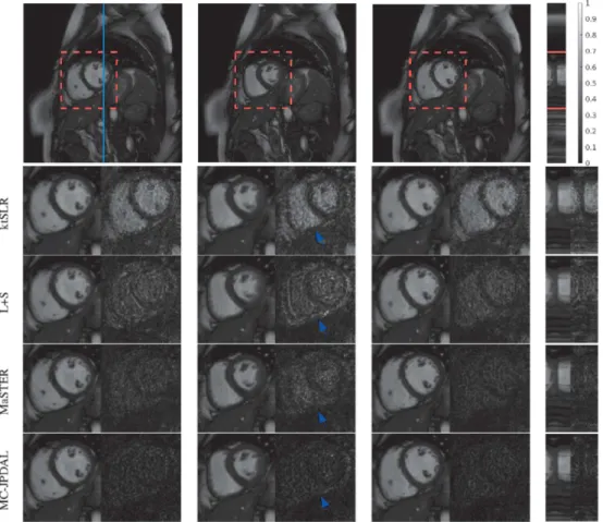 Fig. 5. Reconstruction of cardiac cine MRI scan using different algorithms: frame 3, 16 and 27 and the temporal profile (left to right)