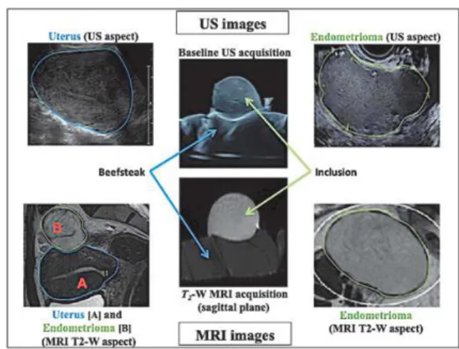 Fig. 2. Representation obtained from MRI 3D reconstruction of the customized phantom.