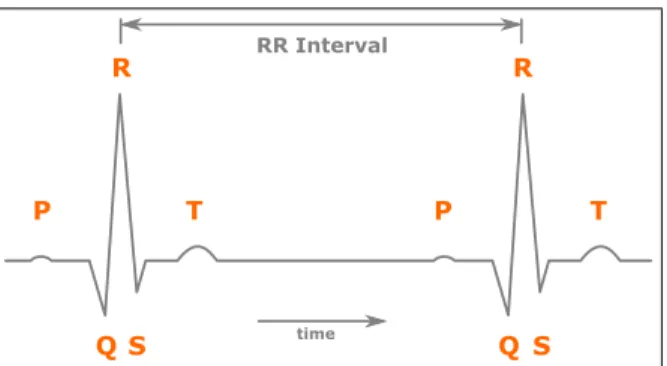 Figure 1. A simplified illustration of two heart beats on an ECG plot, showing QRS complexes and the RR interval.