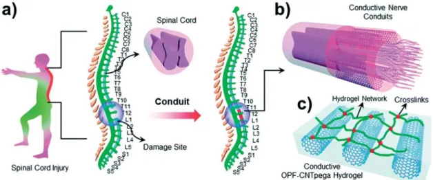 Figure 4. (a) Schematic demonstration of the spinal cord in the human body. (b) Conductive nerve conduits for spinal cord injury treatment