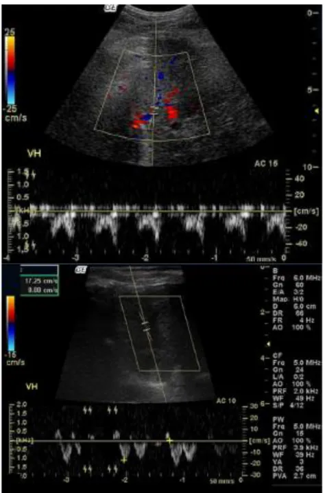 Figure 2 : Images d’échographie Doppler pulsé montrant un profil hémodynamique biphasique de la veine hépatique chez  les chiens obèses (en haut) et un profil triphasique chez les chiens de NEC idéale (en bas) (Belotta et al., 2018)