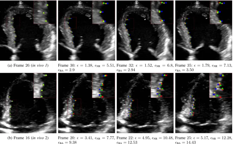 Fig. 12. Tracking results for 6 landmarks on the endocardial wall (magnified in the top-right part of the images) for (a) the in vivo 1 and (b) in vivo 2 sequences