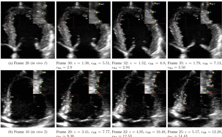 Fig. 12. Tracking results for 6 landmarks on the endocardial wall (magnified in the top-right part of the images) for (a) the in vivo 1 and (b) in vivo 2 sequences