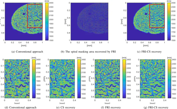 Fig. 2. The first row of the figure shows the recovery process of the SOS 2D map of a chicken tendon tissue