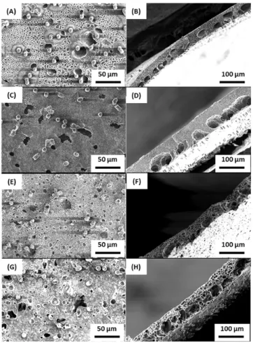 Fig.  2.  SEM  images  of  membranes  on  the  Top  surface  and  cross  section  with  double 