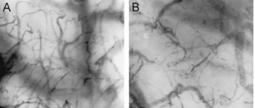 Figure 6 : Image de la microcirculation sublinguale (d’après Siegenthaler et al. 2010)