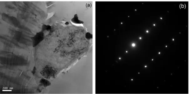 Figure 4 – TEM bright field image of the nucleus seen in Fig. 3 (a) and SAED pattern of the centre  of the nucleus (b)