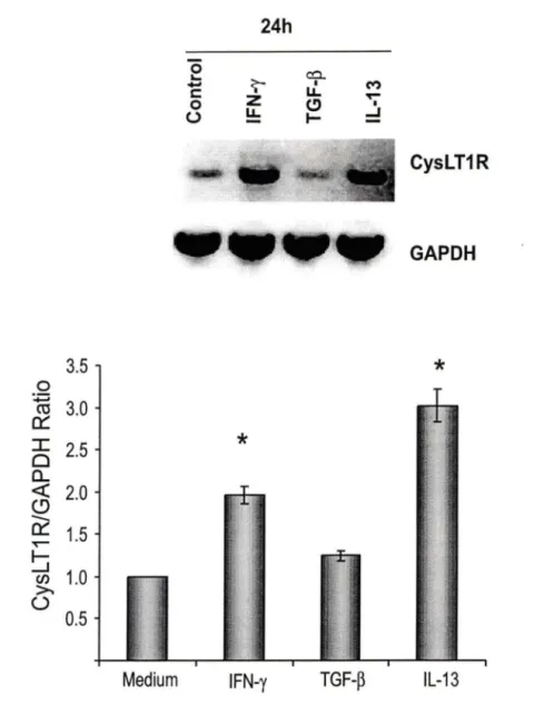Fig  6.  Effect  of IFN-y,  TGF-B  and  IL-13  on  CysLT1R  mRNA  expression.  (A)  BSMC  were  stimulated  for  24h  with  100  U/ml,  10ng/ml  and  5ng/ml  of  IFN-y,  TGF-B  and  IL-13  respectively