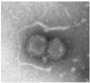 Figure  3  :  Virus  influenza  D  (C/OK)  en  microscopie  électronique  l’hémagglutinine  de  l'enveloppe  forme  un  halo  caractéristique  autour  des  particules virales en coloration négative (190)