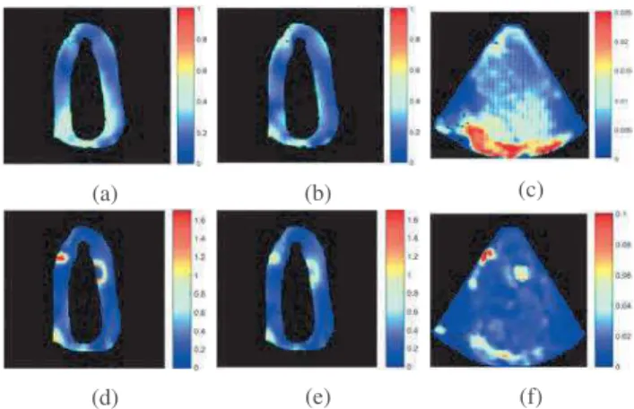 Fig. 2: Motion error maps for (a,d) the native sequence and (b,e) the corrupted sequence with the corresponding anomaly matrices E (for (c) the native and (f) the corrupted sequences).