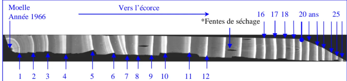 Figure 2-3.  Exemple d’un cliché radiographique depuis la moelle du Douglas choisi (disque 5) 