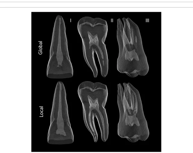 Figure 4.  Schematic representation of a root canal section. Quantitative metrics measured for comparison between CBCT and  µCT: 
