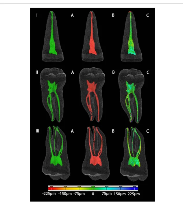 Figure 6.  3D visualizations of the segmentations with the incisive (I) at the top, the lower molar (II) in the middle and the upper 