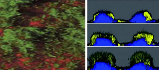 Figure  3 :  Exemples  de  structuration  d’un  biofilm  observé  en  épifluorescence