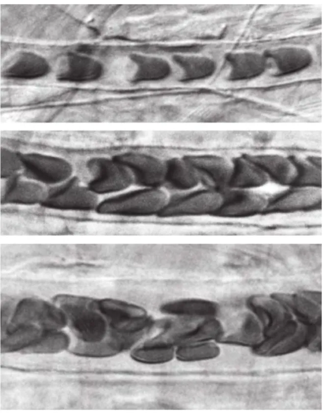 Figure 3.2 – Effet Fåhareus in vivo dans le mésentère du rat pour des vaisseaux de 7, 12 et 16 µm de diamètres .Le sang s’écoule de gauche à droite