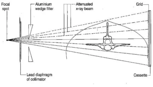 Figure 11 : Utilisation d'un prisme d'aluminium lors de clichés radiographiques (d'après Janet et al, 2017)