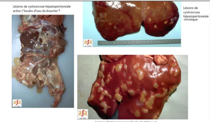 Figure 8 : Comparaison des lésions hépatiques d’une cysticercose hépatopéritonéale (active et  chronique) et d’une échinococcose