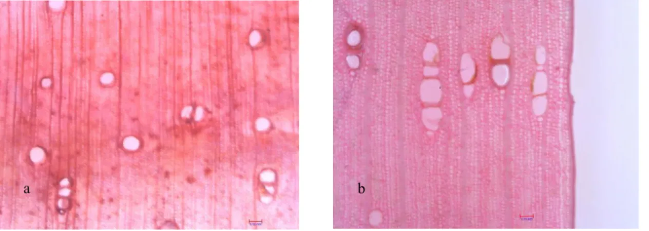 Figure 1  Microstructure of 5 years old sengon (a) and jabon (b) near bark with  magnitude 300x 