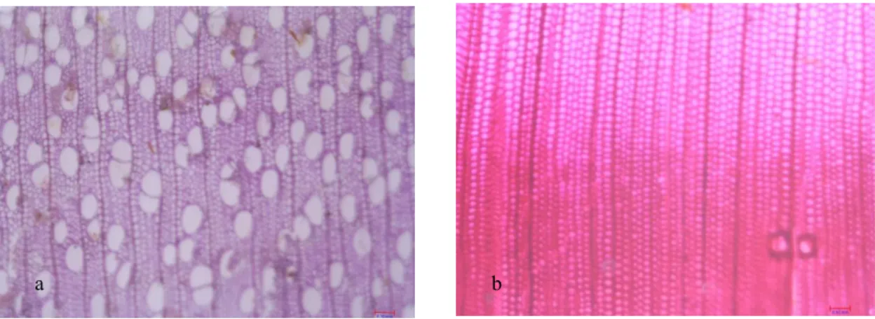 Figure 2  Microstructure of 18 years old poplar cultivar ‘I214’ (a) and 26 years  old Douglas-fir (b) near bark with magnitude 300x 