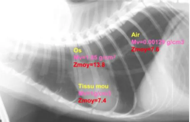 Figure 2 : Radiographie thoracique d’un chat et mise en exergue des différences d’opacité en lien avec la densité et le  numéro atomique de la matière traversée